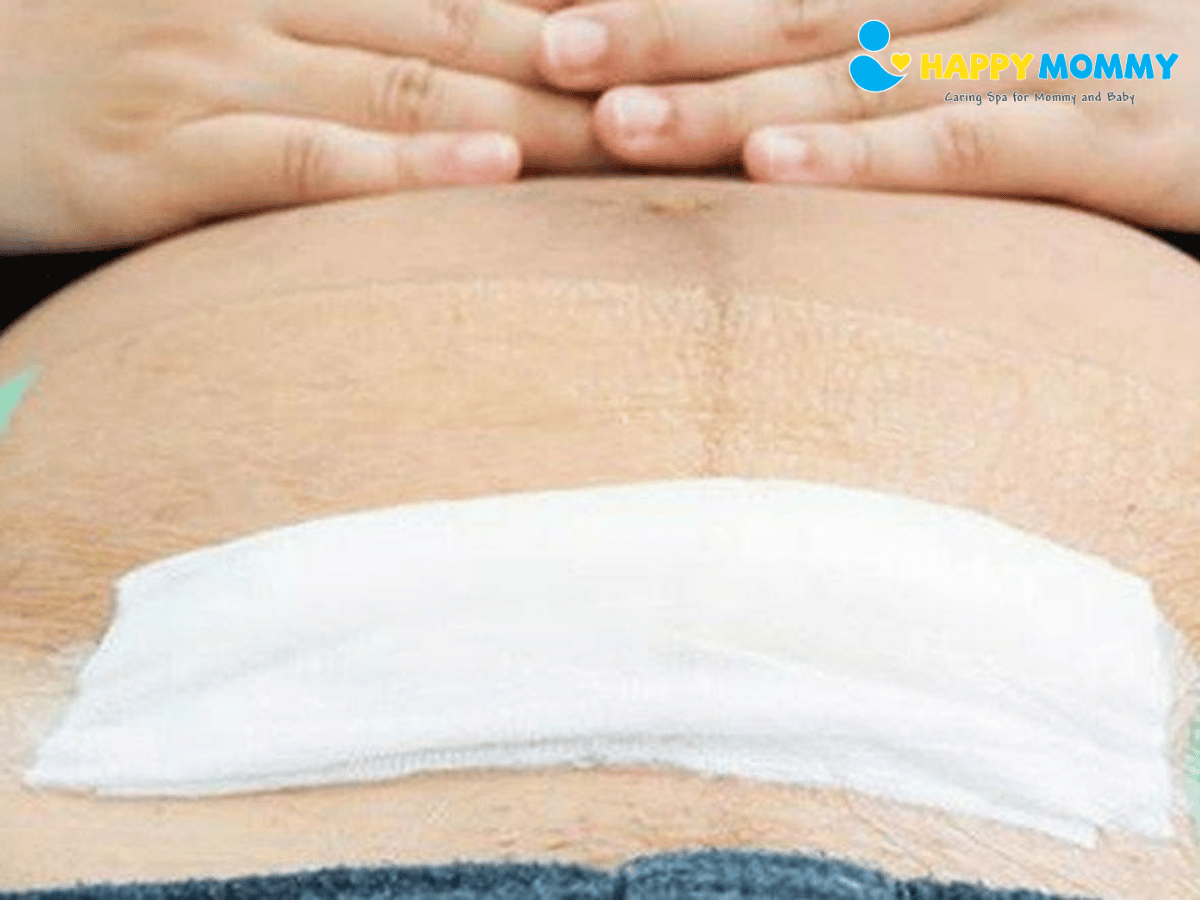 cham-soc-vet-mo-sau-sinh